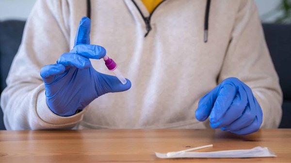 Choisissez Lysi France, votre fournisseur d'huile de foie de morue directement de l'Islande